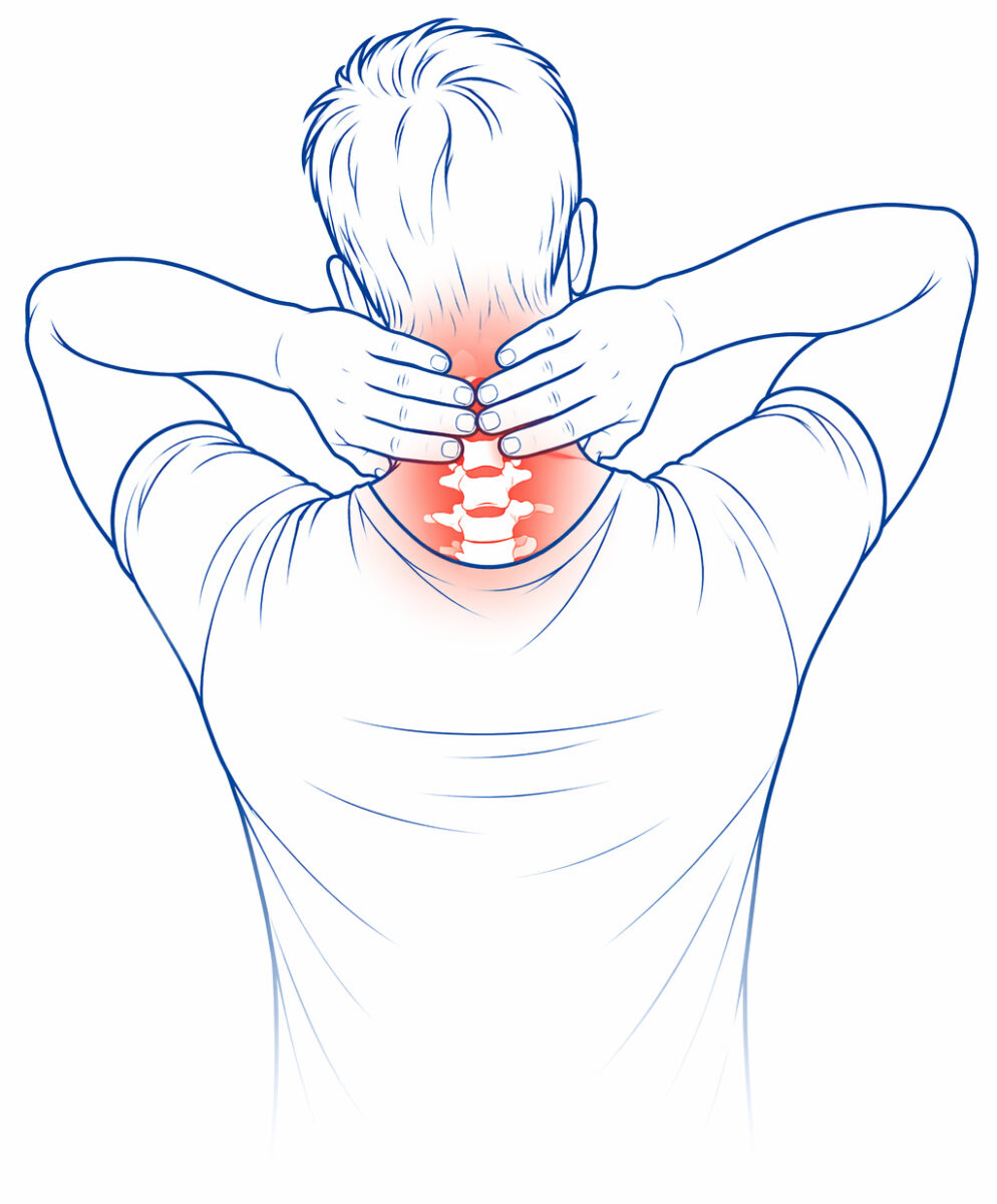 Neck Pain